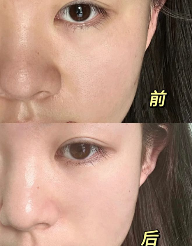 推荐揭晓：热门面膜排行榜前十名！麻将胡了模拟器国产十大品牌面膜(图4)